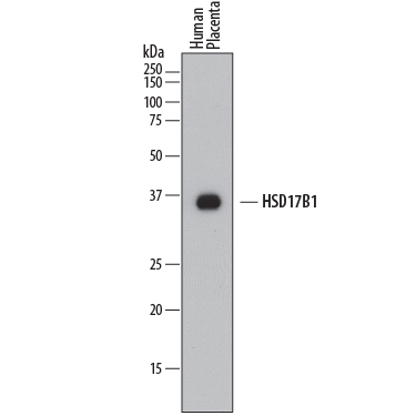 Detection of Human 17  beta-HSD1/ HSD17B1 antibody by Western Blot.
