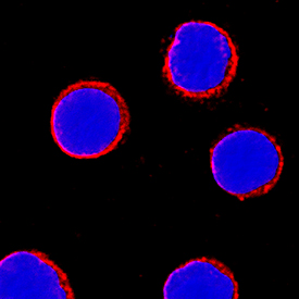 CD5 antibody in Human PBMCs by Immunocytochemistry (ICC).