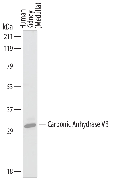 Detection of Human Carbonic Anhydrase VB/CA5B antibody by Western Blot.