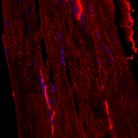 Desmin antibody in Mouse Skeletal Muscle by Immunohistochemistry (IHC-Fr).