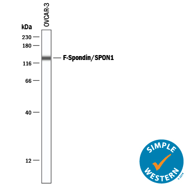 Detection of Human F-Spondin/SPON1 antibody by Simple WesternTM.