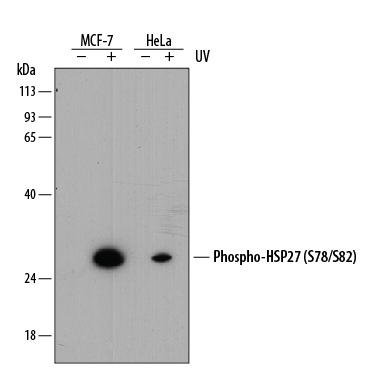 Detection of Human Phospho-HSP27 (S78/S82) antibody by Western Blot.