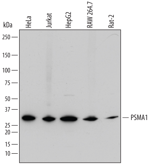 Detection of Sheep IgG Primary Antibody by Western Blot