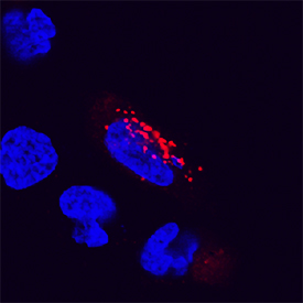 Human LAMP‑2/CD107b Antibody (AF6228) | Bio-Techne