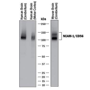 Detection of Human and Mouse NCAM-1/CD56 antibody by Western Blot.