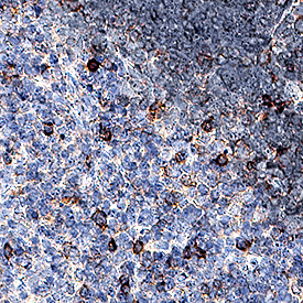 PD-1 antibody in Mouse Thymus by Immunohistochemistry (IHC-P).