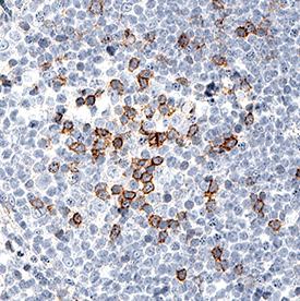 PD-1 antibody in Human Tonsil by Immunohistochemistry (IHC-P).