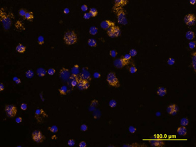 TGF-beta  RI/ALK-5 antibody in Human PBMCs by Immunocytochemistry (ICC).