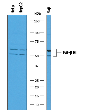 Detection of Human TGF-beta  RI/ALK‑5 antibody by Western Blot.