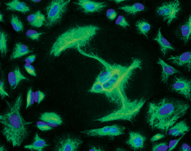 Vimentin antibody in A549 Human Cell Line by Immunocytochemistry (ICC).