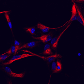 Vimentin antibody in Mouse Cortical Stem Cells by Immunocytochemistry (ICC).