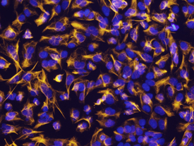 Vimentin antibody in NTera-2 Human Cell Line by Immunocytochemistry (ICC).