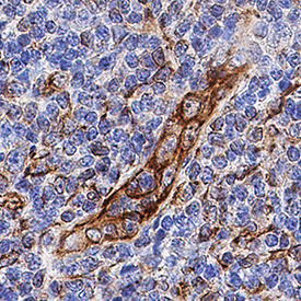 Vimentin antibody in Human Tonsil by Immunohistochemistry (IHC-P).