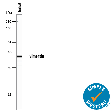 Detection of Human Vimentin antibody by Simple WesternTM.