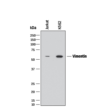 Detection of Human Vimentin antibody by Western Blot.