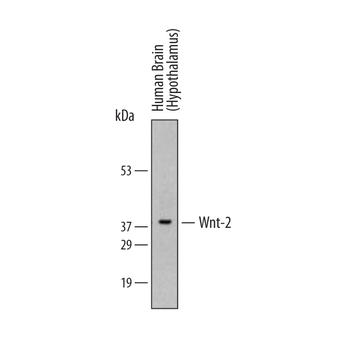 Detection of Human Wnt-2 antibody by Western Blot.