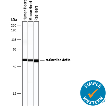 Detection of Human, Mouse, and Rat a-Cardiac Actin antibody by Simple WesternTM.
