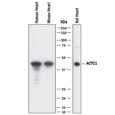 Detection of Human, Mouse, and Rat a-Cardiac Actin antibody by Western Blot.